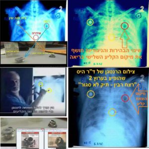 צילומי הרנטגן של ד"ר הס